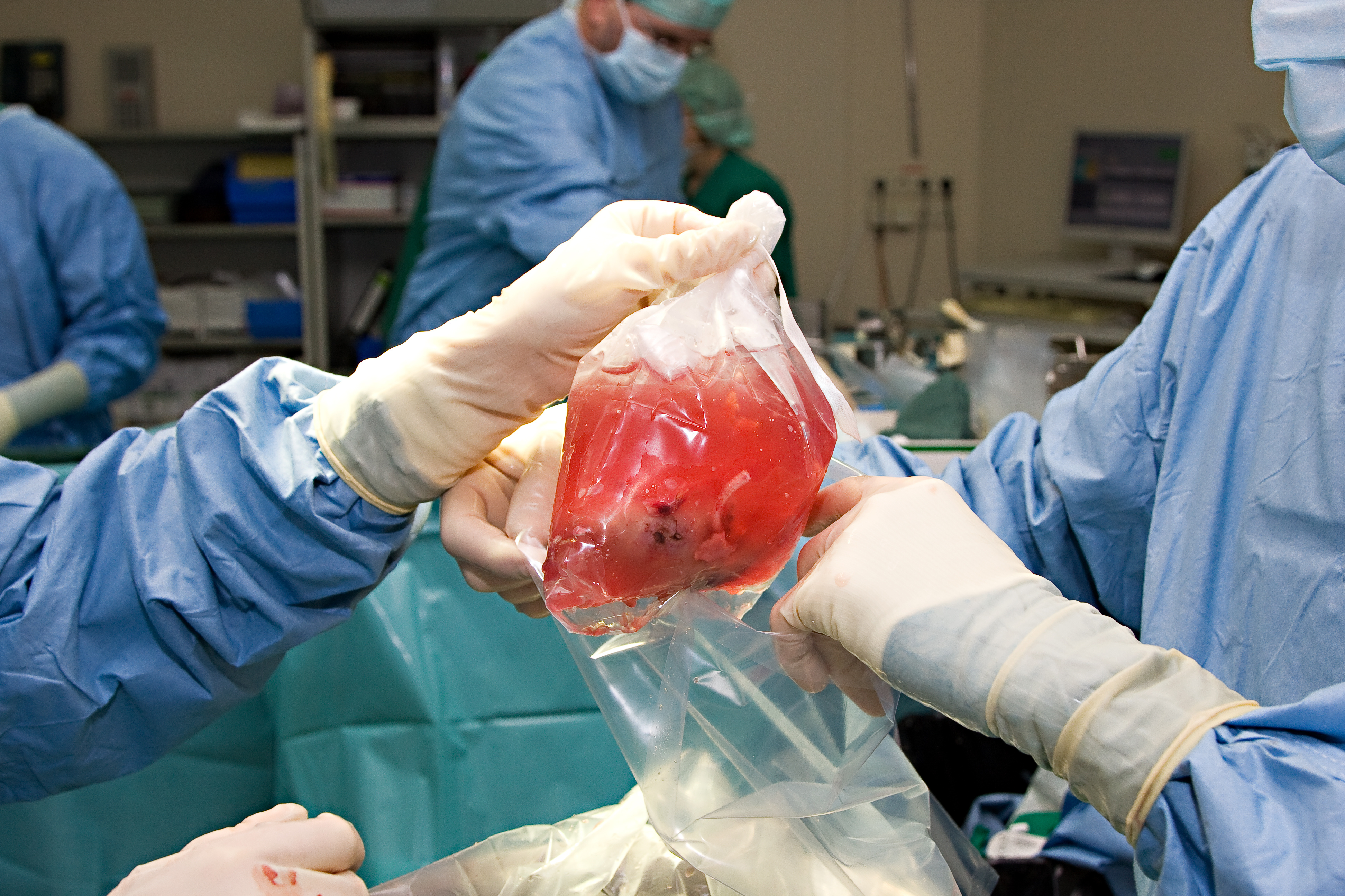 Organtransplantation